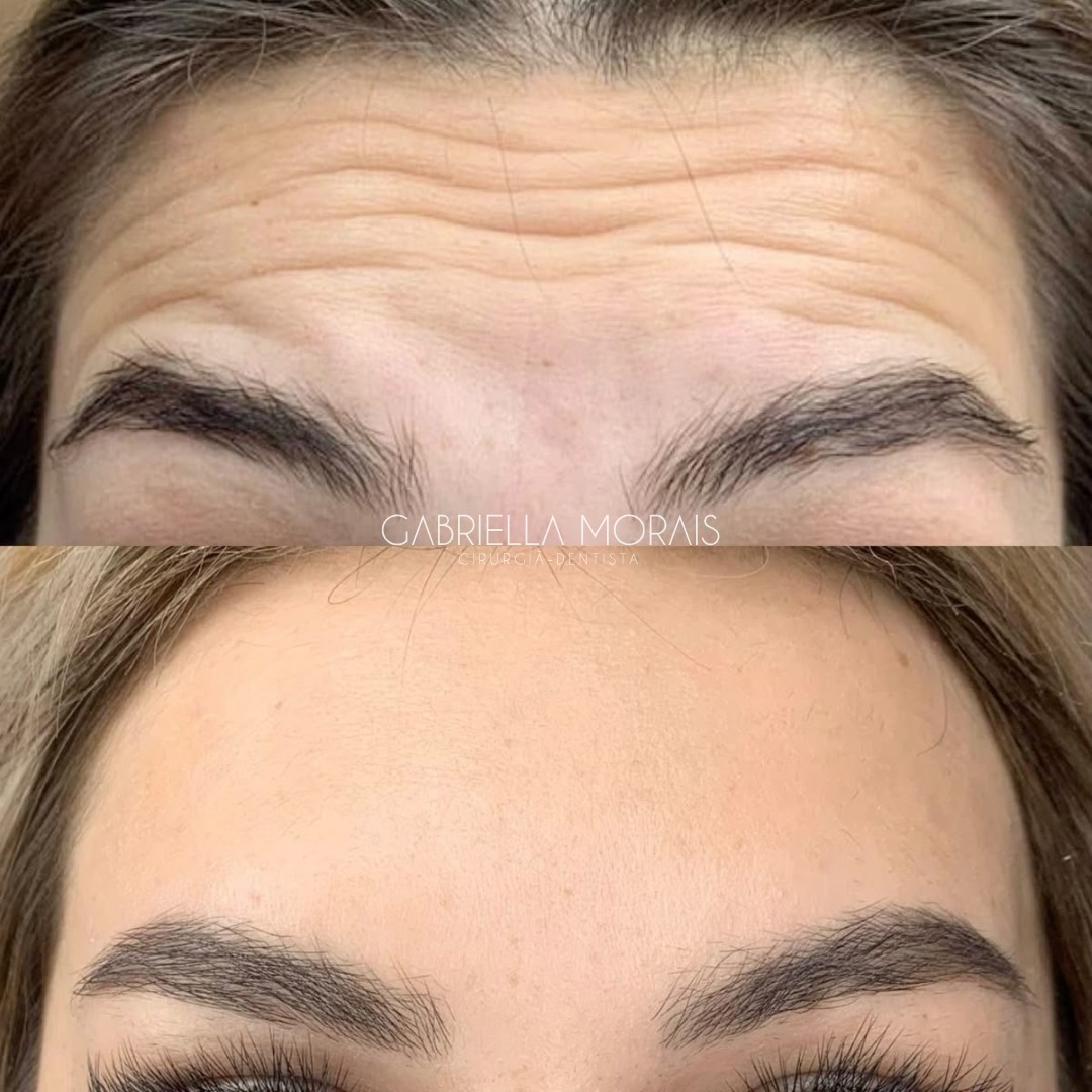 Caso 16 - Antes e Depois